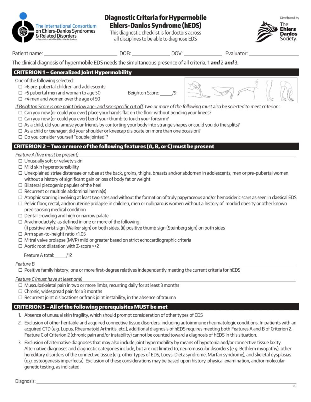 Hypermobile Ehlers Danlos diagnostic criteria. The Cusack Protocol for Ehlers Danlos Syndrome.